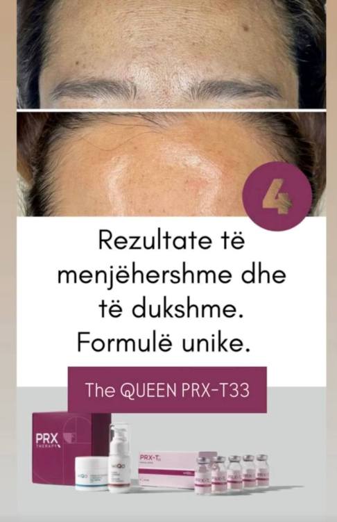 Dy trajtime per lëkur te shendetshme te tendosur dhe me shkelqim✨️✨️
PASTRIMI I THELE & COLD PLAZMA Dr Platon💎💎
💎Pas largimit te pikave te zeza yndyres se tepert dhe grumbullimeve te padeshiruara ne lekur te cilat e bllokojne funksion normal te lekures vazhdohet me trajtimin me 💎Cold Plazma e dr Platon fitues i shume qmimeve ka nje spekter te gjere te veprimit si
-Veprim antibakterial dhe anti-inflamator
-Zbeh njollat dhe shenjat e akneve
-Rigjeneron qelizat e lëkurës
-Përmirëson elasticitetin dhe tonin
-Rregullon pH-në dhe balancën e lëkurës
-Rrit qarkullimin e gjakut dhe oksigjenimin
-Detoksifikon dhe pastron në nivel mikroskopik...